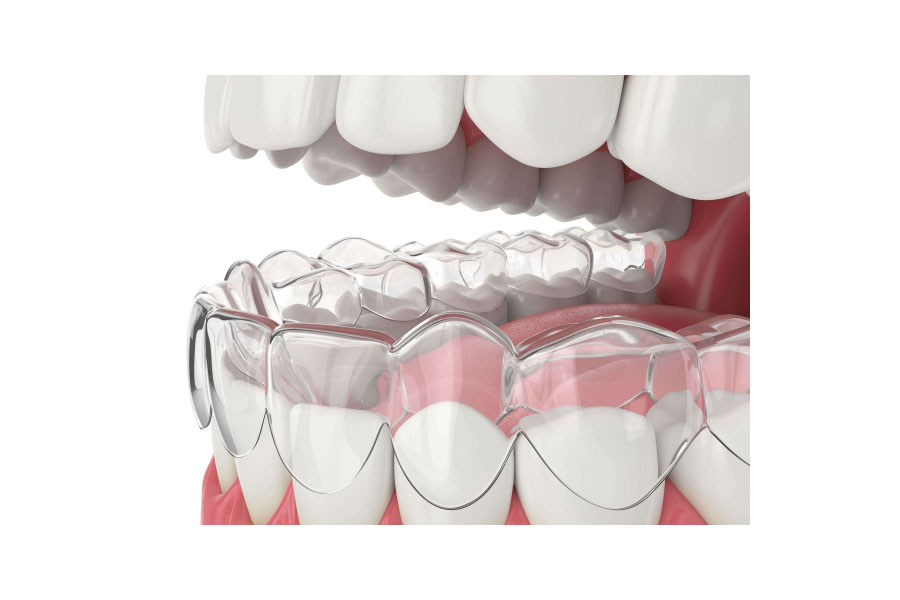 nieng-rang-trong-suot